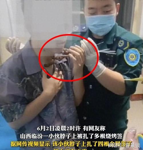 澳门研究生资料网站大全,和脖子被扎多根烧烤签与被烧烤签子扎出血了